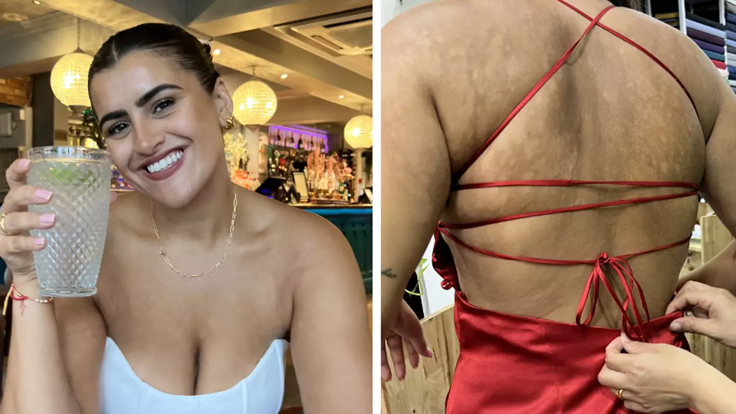 Stranger diagnoses woman with serve skin infection after spotting rash on TikTok video