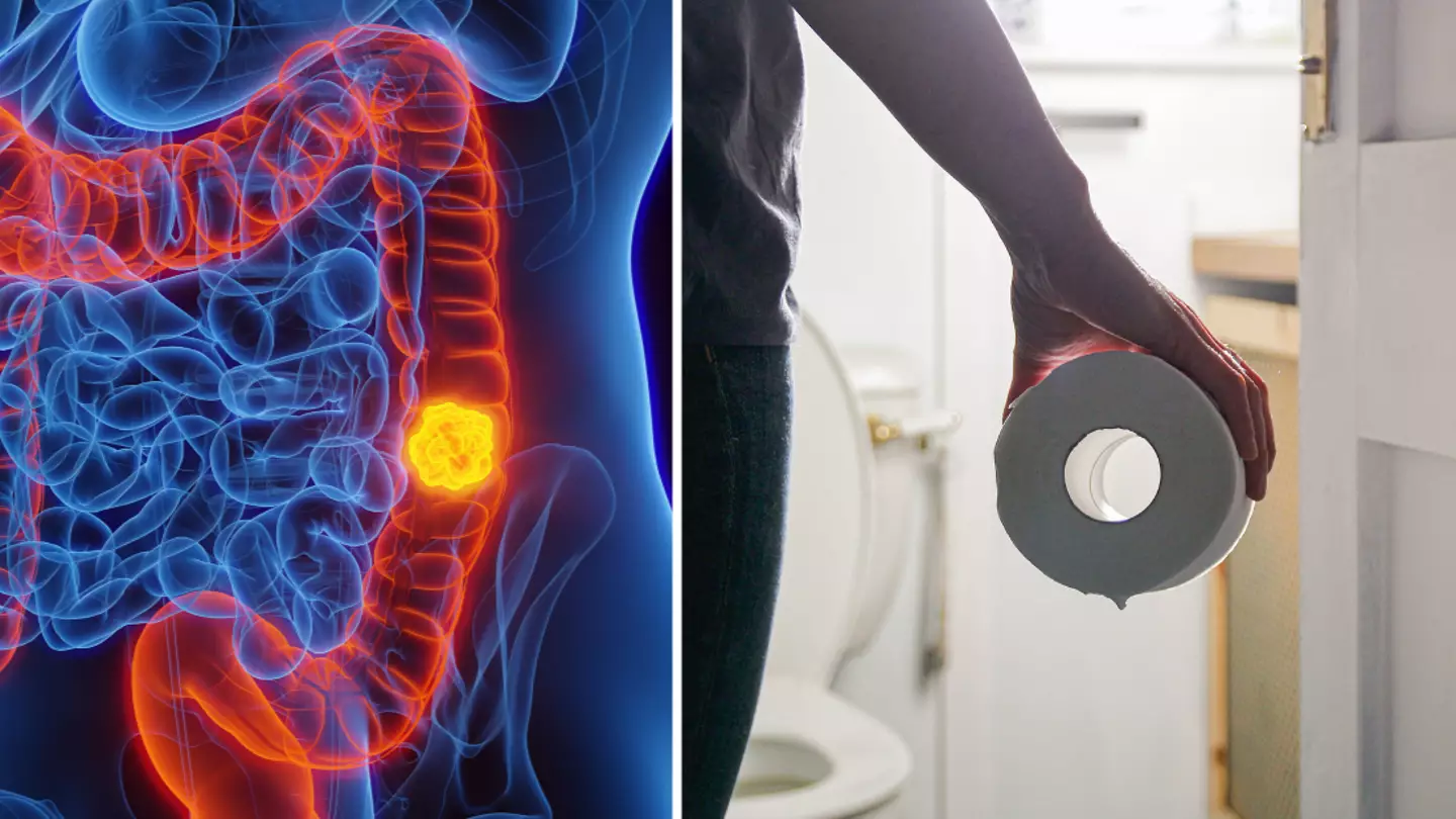 Experts warn certain colour of poo is red flag sign of cancer and you should see doctor urgently