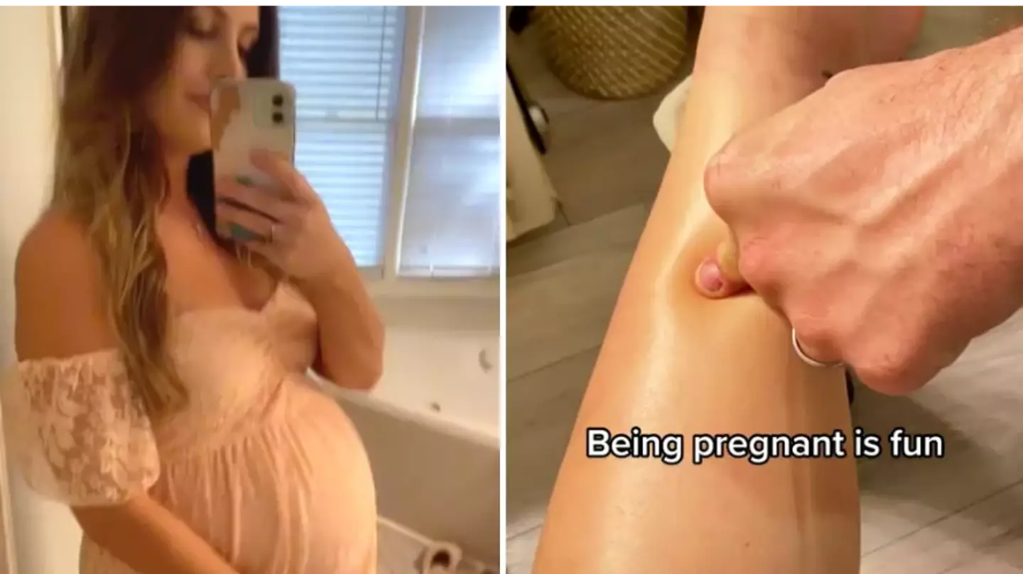 People Are Stunned As Woman Shares Little-Known Side Effect Of Pregnancy