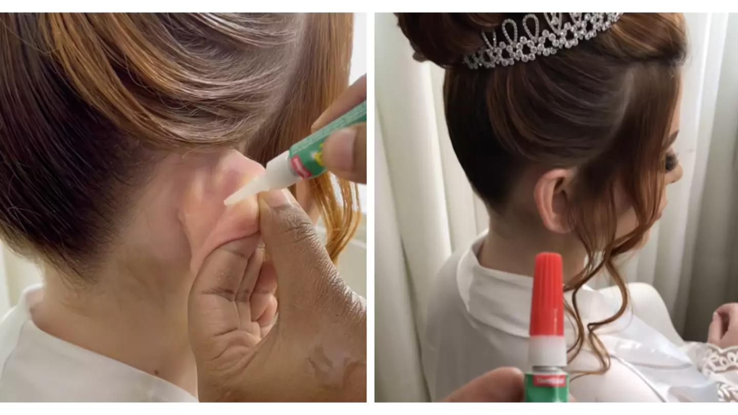 Bride super glues her ears to her head for wedding pics but people are divided