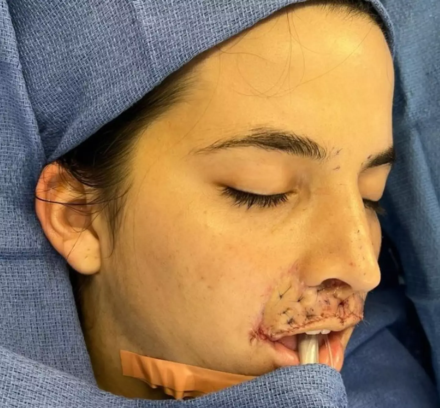 Brooklinn showed the results of her successful surgery.