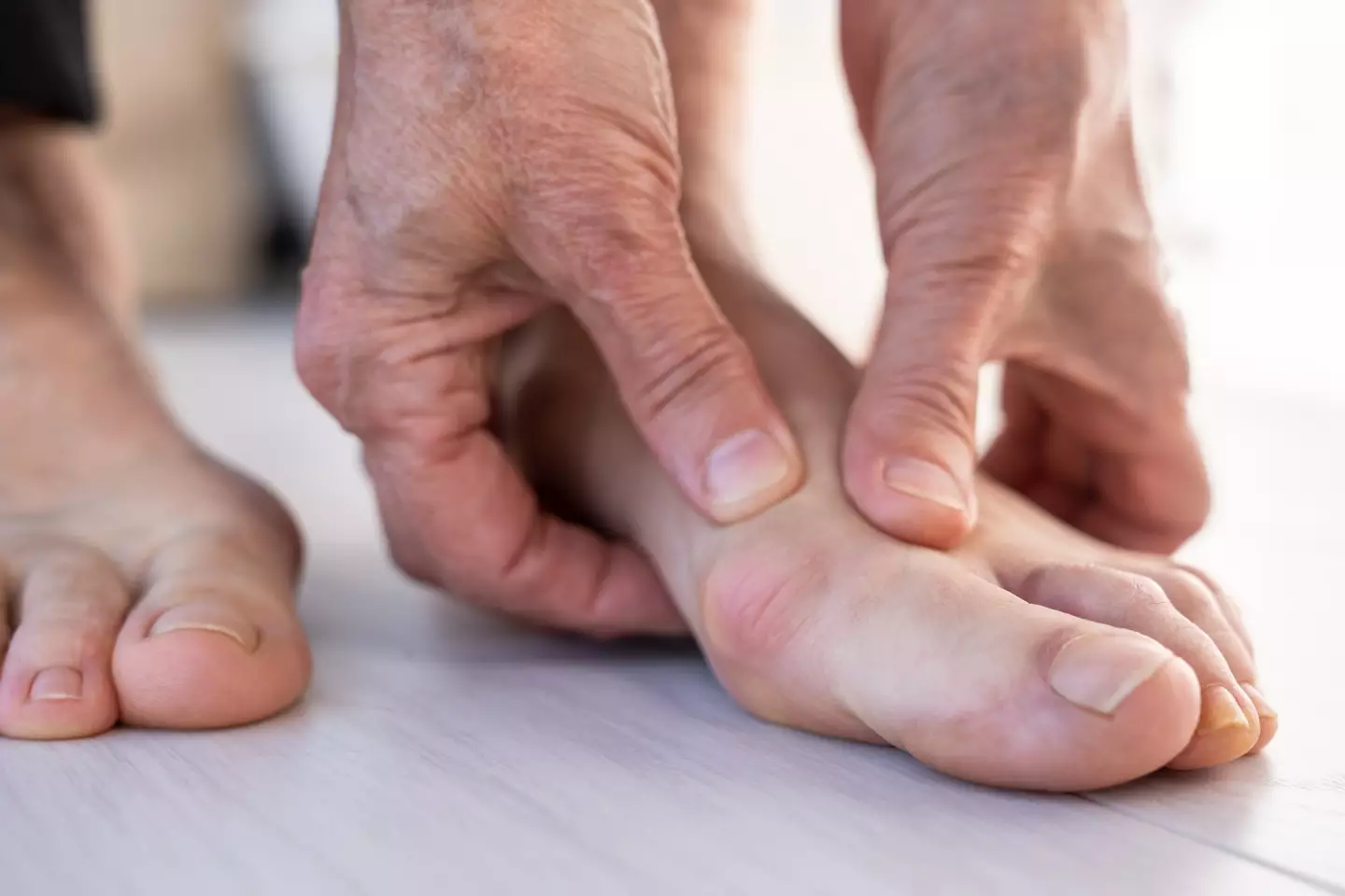 Scientists have various theories on why bunions form (Getty Stock Image)