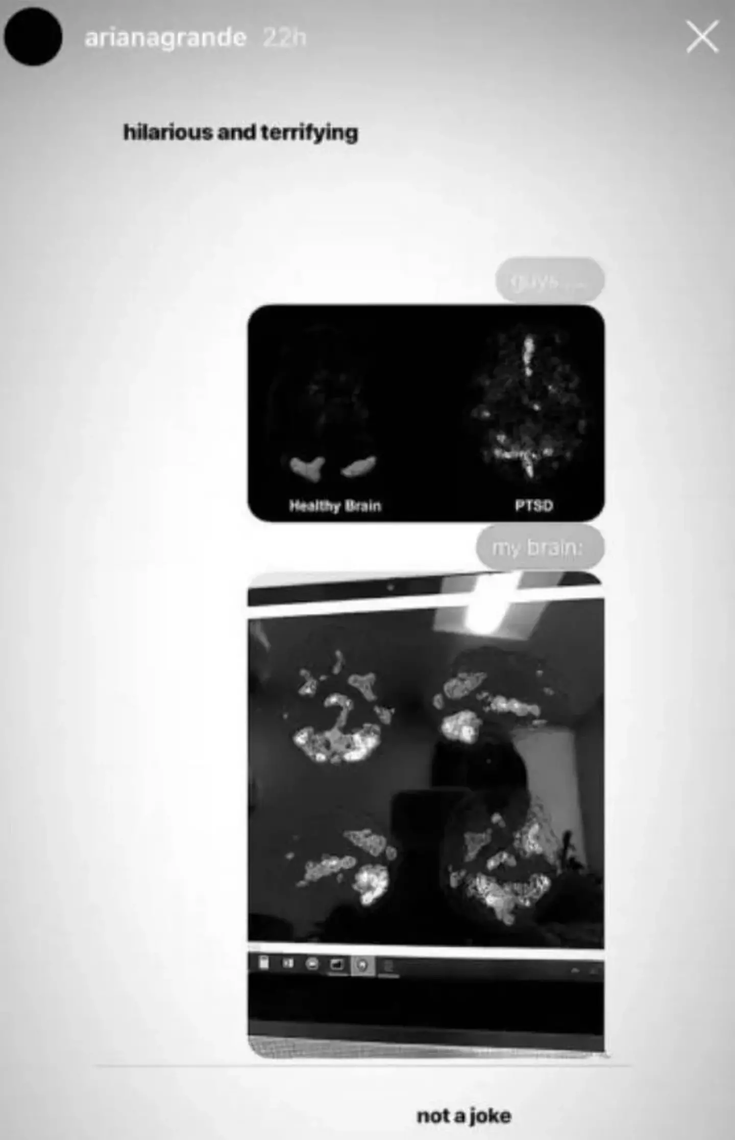 Ariana Grande shared images of her brain scan back in 2019 (Instagram/@arianagrande)