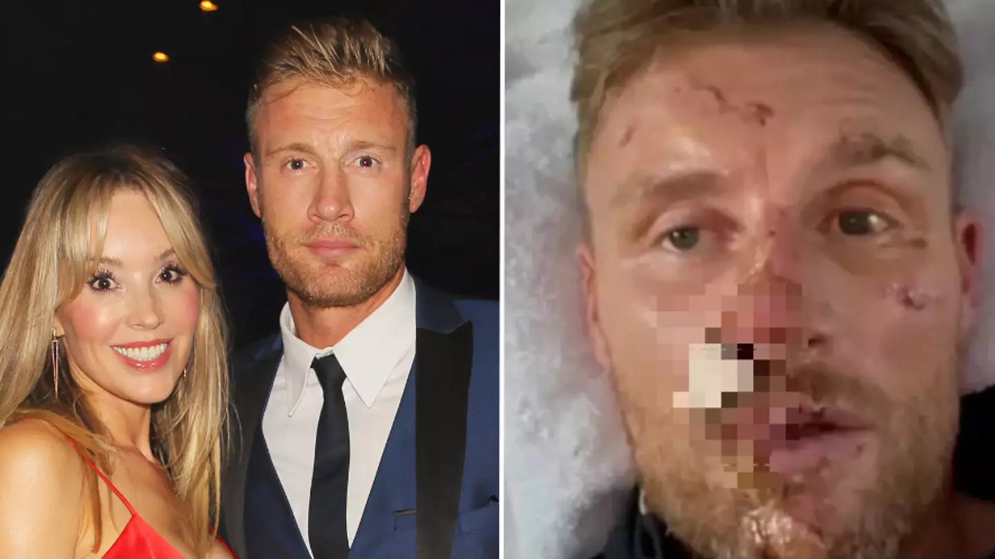Freddie Flintoff's wife was given heartbreaking warning before she was allowed to see horrifying results of star's near-fatal crash