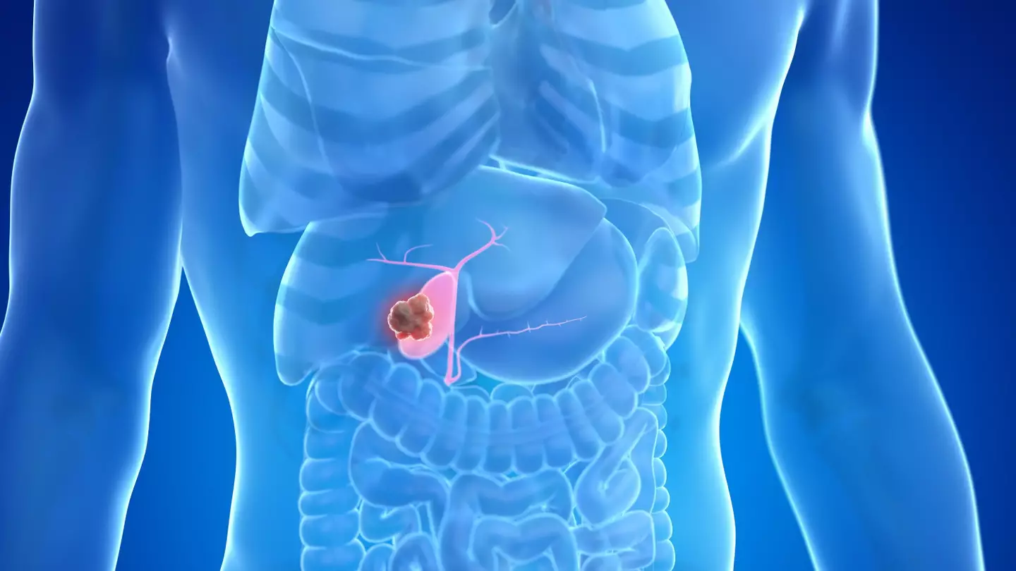 Oncologists are warning of the dangers. (Getty Stock Images)