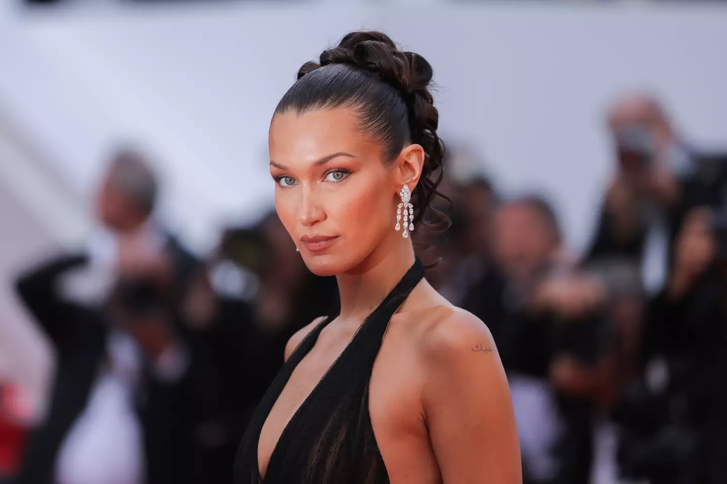 Bella Hadid was diagnosed as a teenager (Victor Boyko/Getty Images)