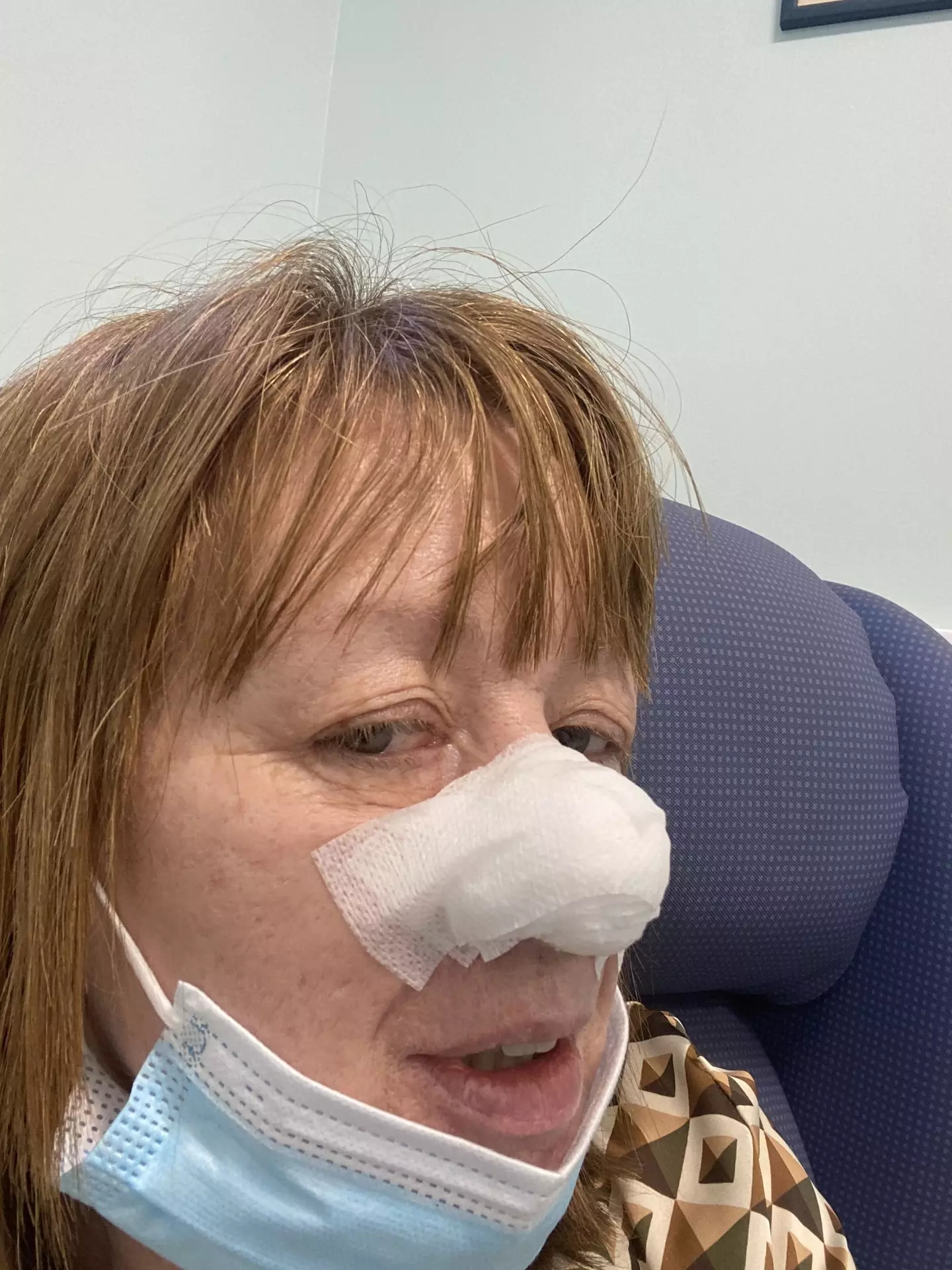 Sarah had to have a chunk of her nose removed.