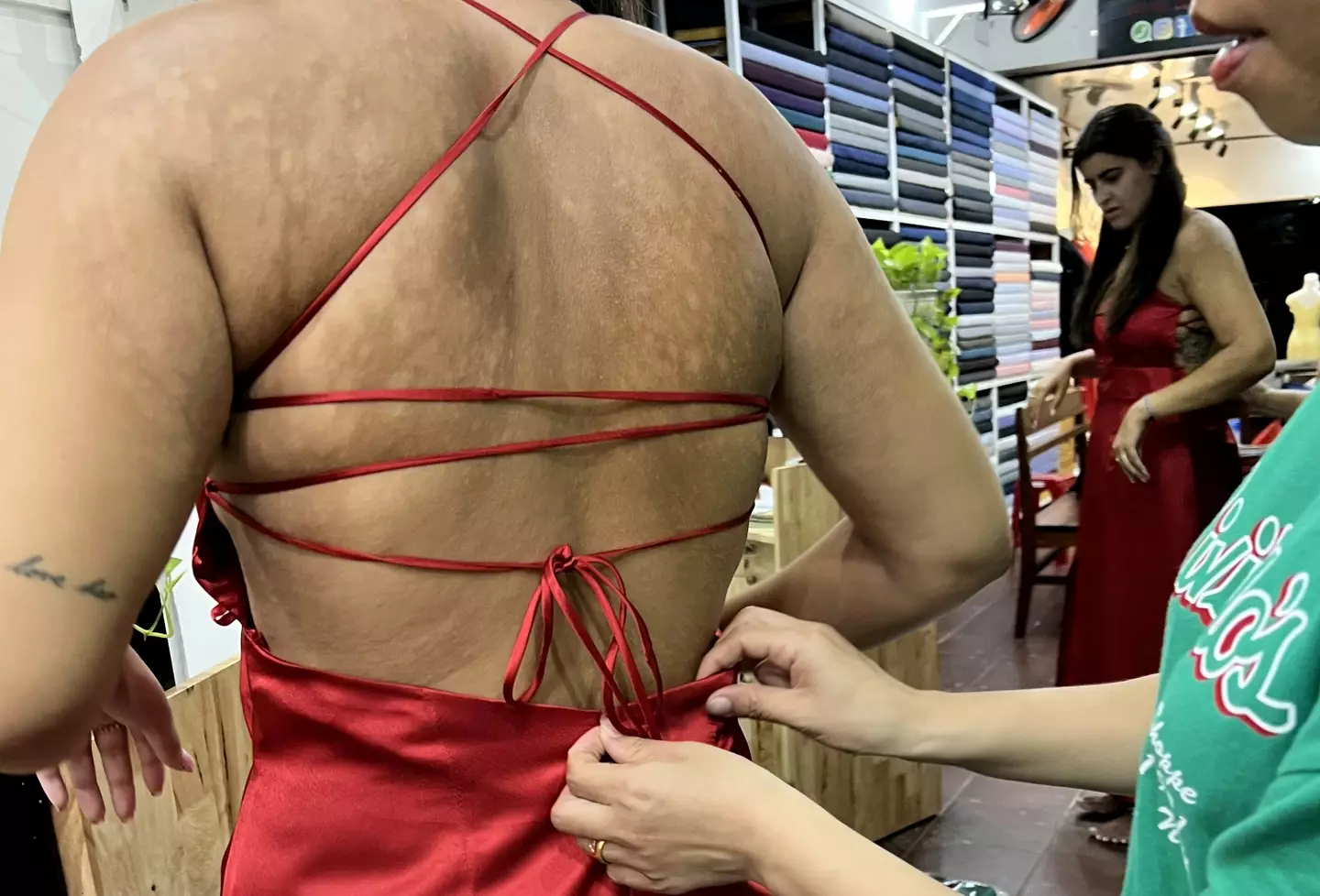 The influencer, 21, explained that the follower told her to go to a doctor after seeing a mark on her back.