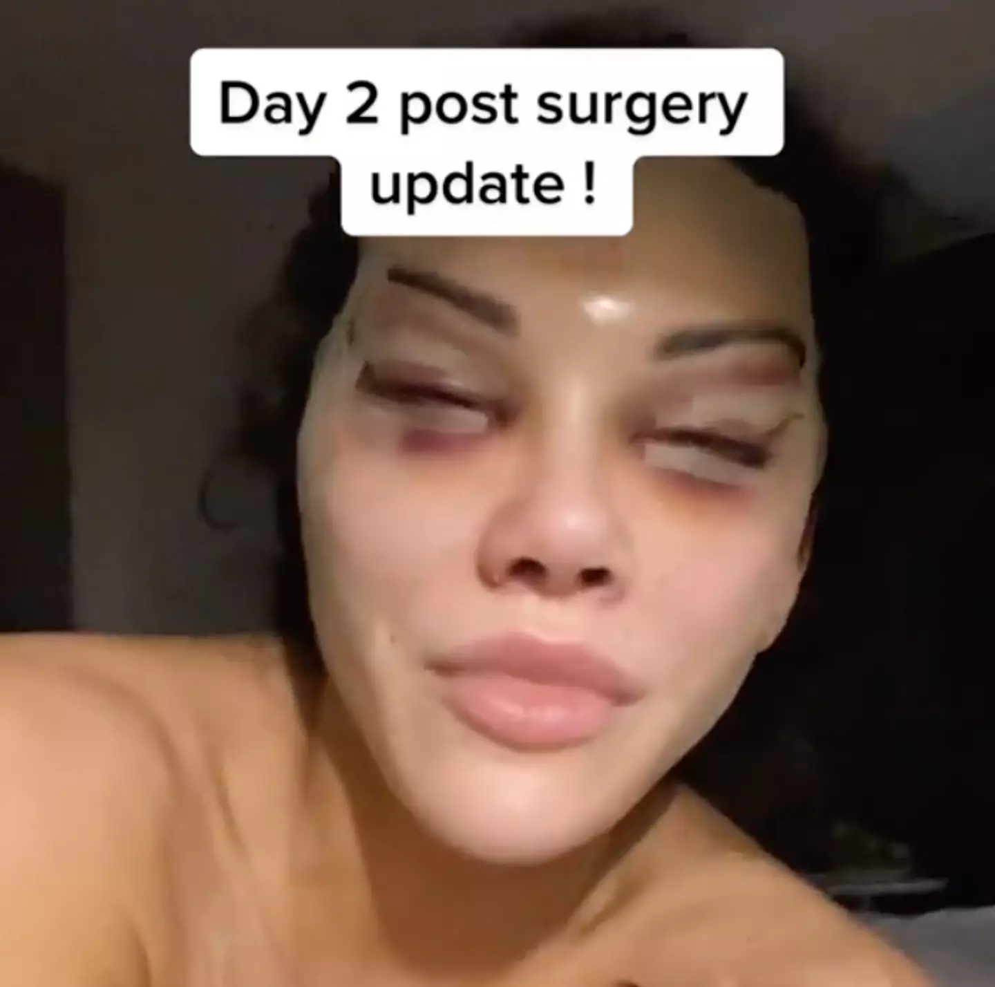 Nasrin has kept fans updated with her recovery.