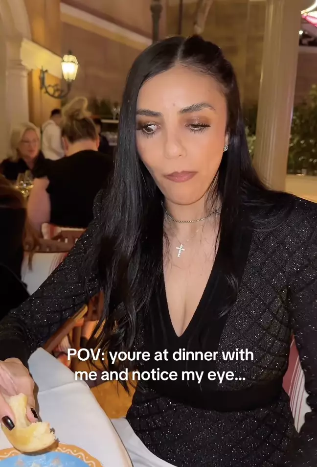 Marion has turned down surgery as she's 'learned to be confident in it and embrace it' (Instagram/marionsworldd)