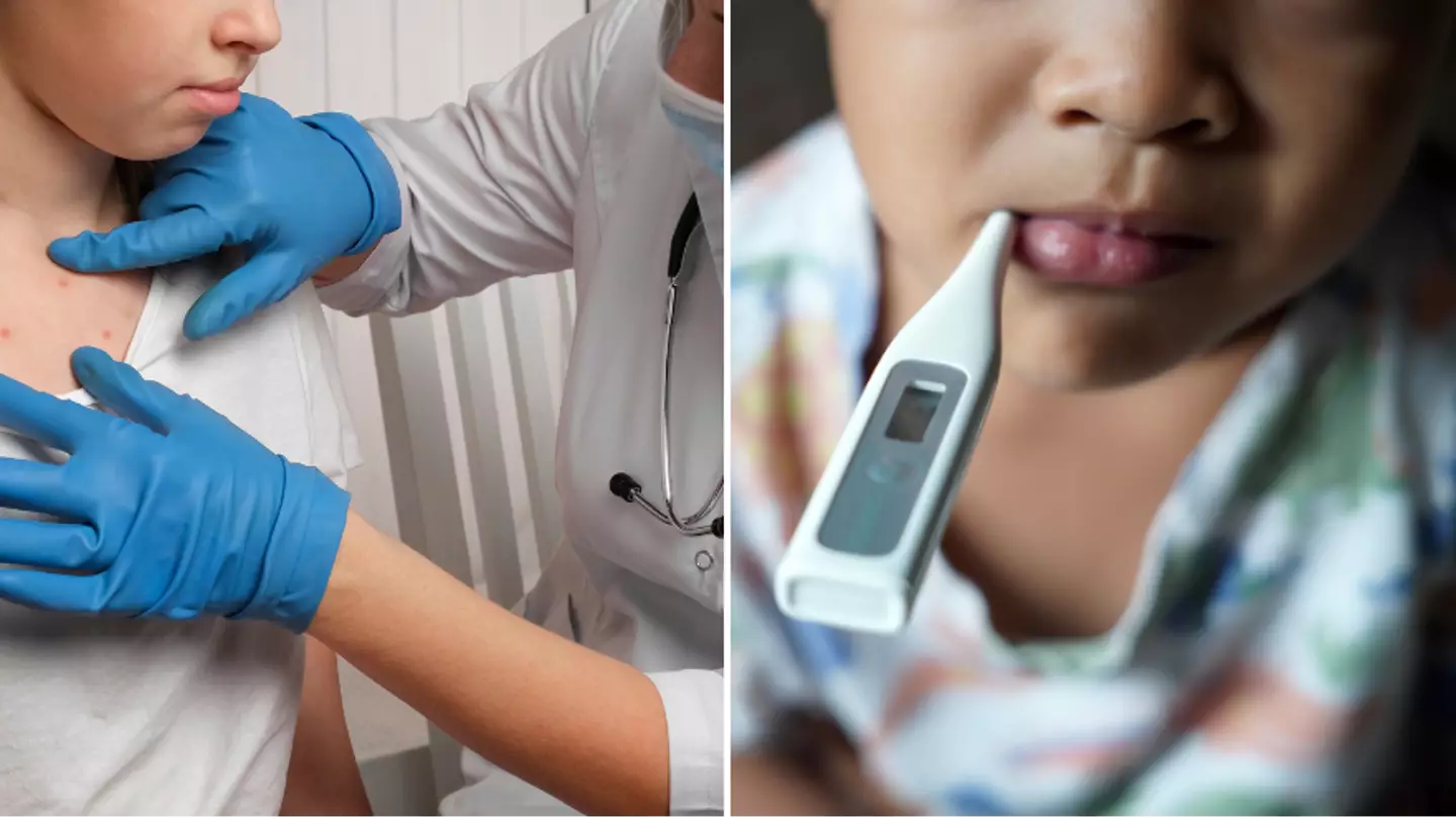 Health expert says urgent action needed after outbreak of measles across UK
