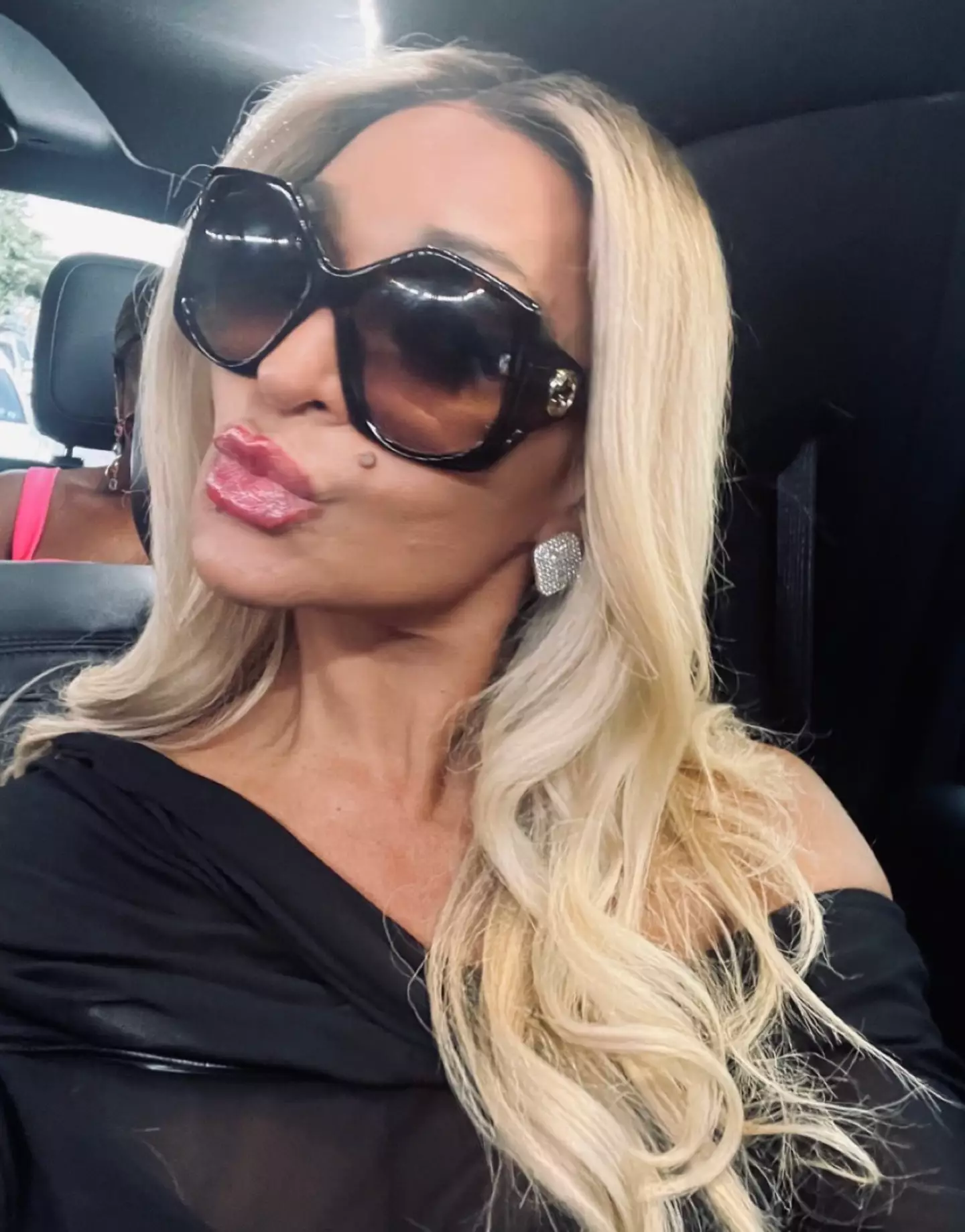 The Real Housewives star thanked fans for their well-wishes following her accident.