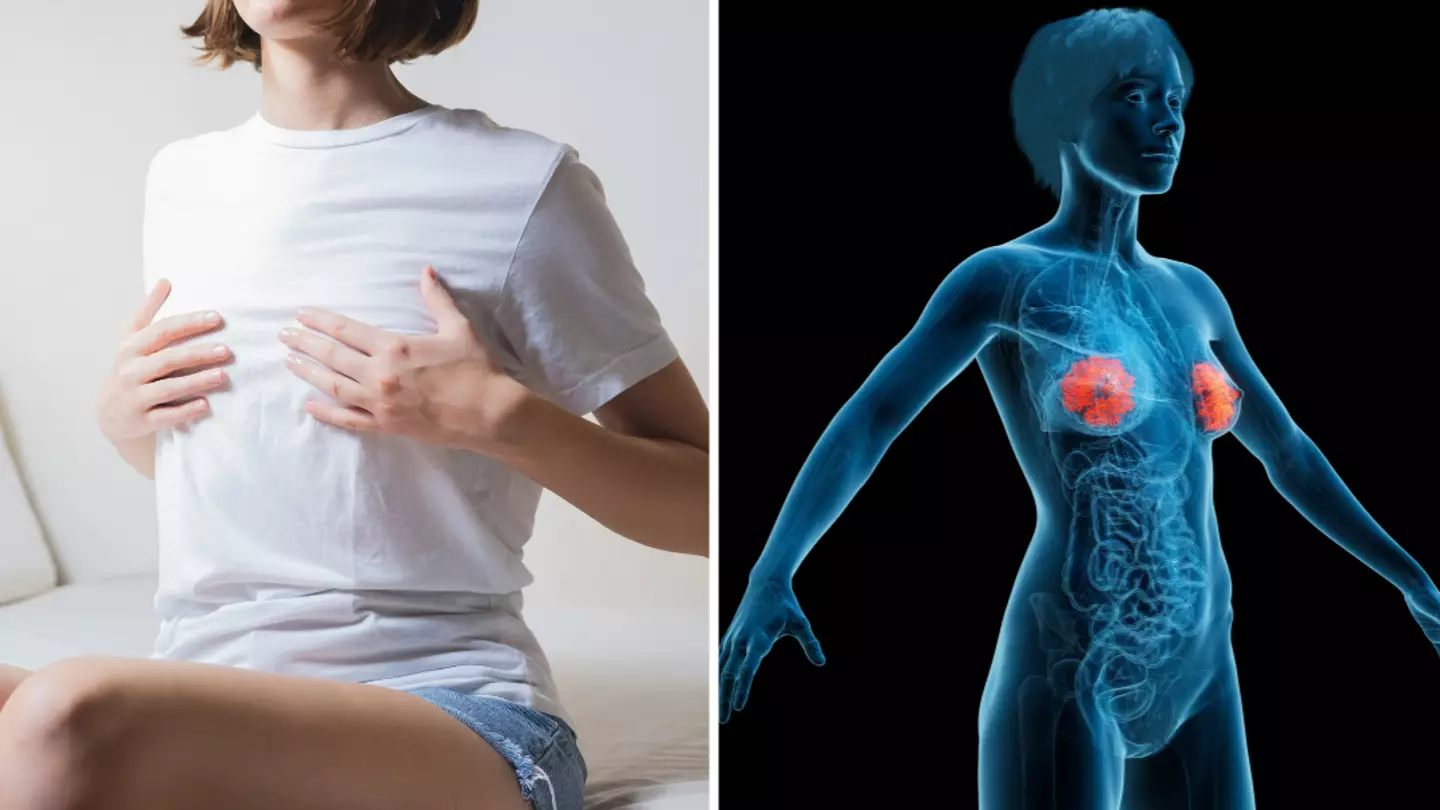 ‘Burger nipples’ explained as doctor makes important clarification for people who have them