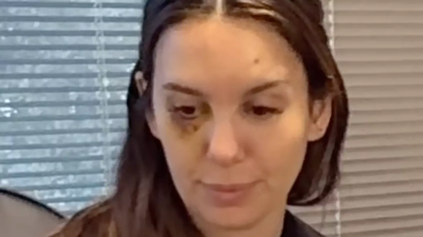 Disney star Christy Carlson Romano gives update after being shot in the face on date with husband