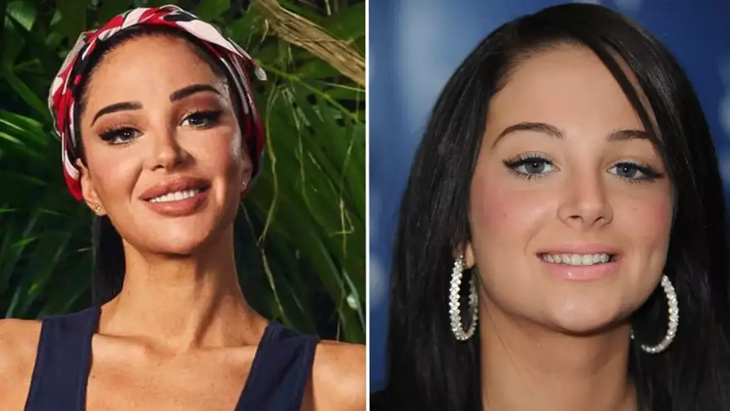 Doctor issues urgent plea after I’m A Celeb’s Tulisa reveals heartbreaking reason why she’s had plastic surgery