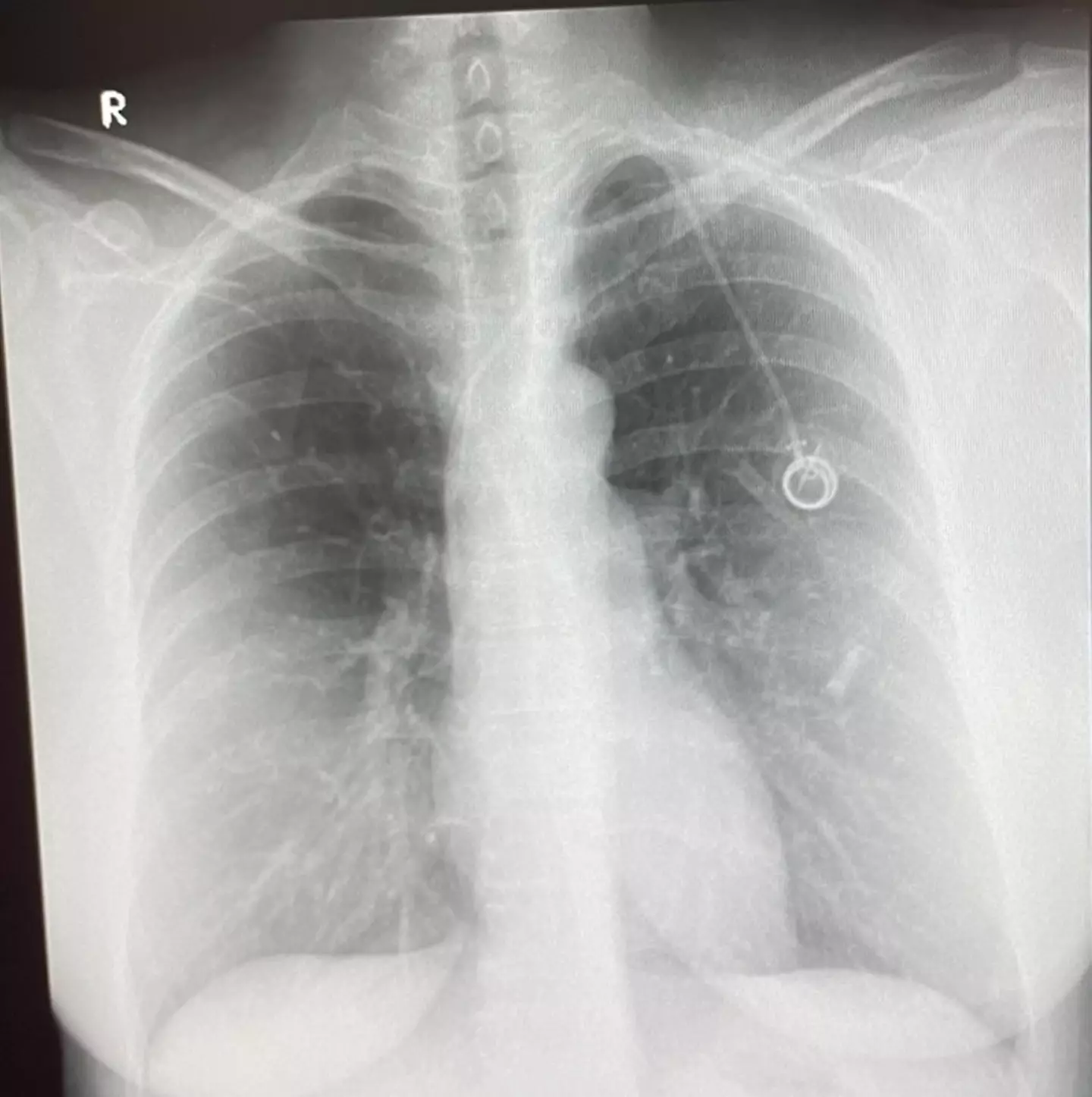 The mother is now under palliative care. (Kennedy News and Media)