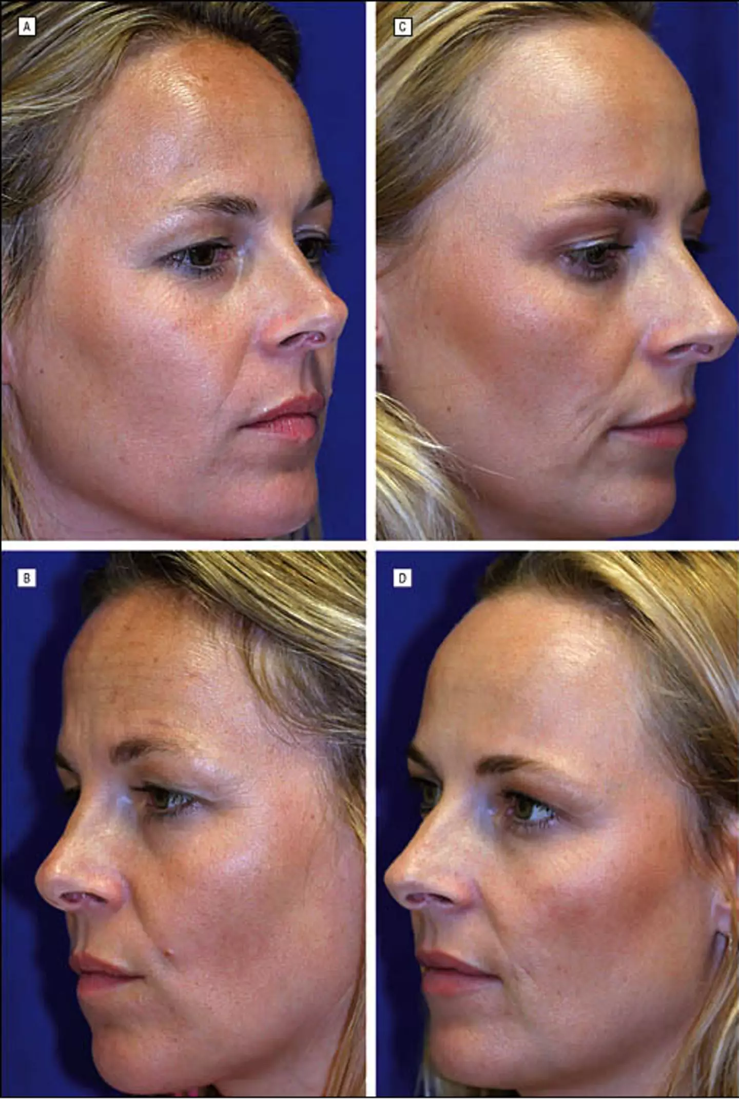 There were many notable differences between the two twins (American Society for Dermatologic Surgery)