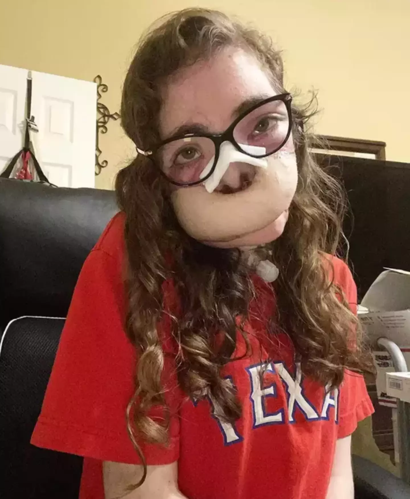 Jacqueline was attacked by two dogs back in 2021.