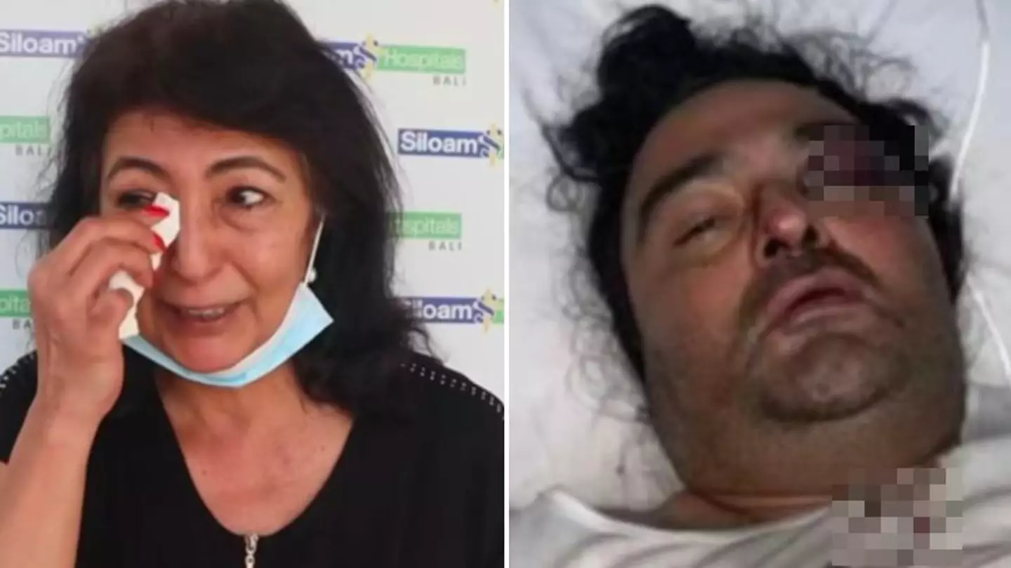 Mum issues warning to holidaymakers after son severely injured in Bali