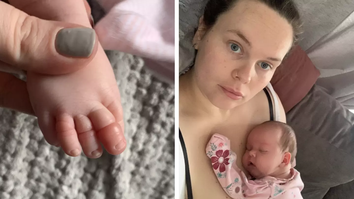 Mum issues warning after baby girl 'nearly lost her toe' over single strand of hair