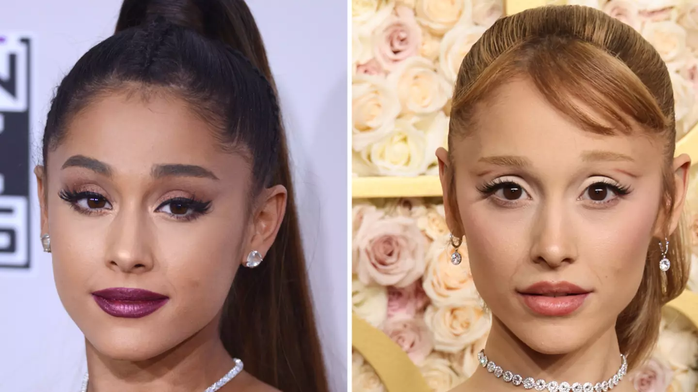 Ariana Grande sets the record straight on botox use after joke leaves fans confused