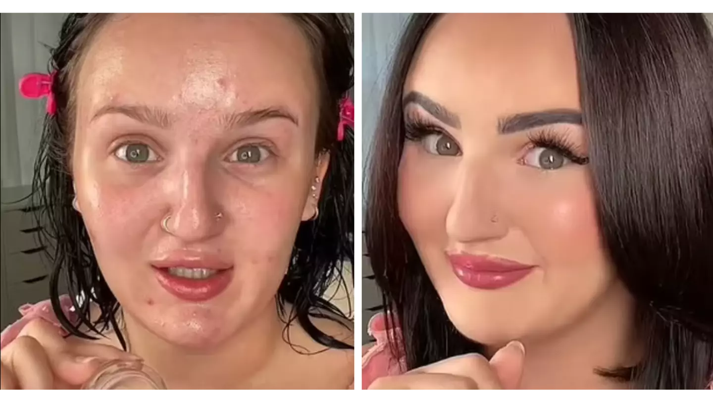 Makeup artist praised for how perfectly she covers up acne