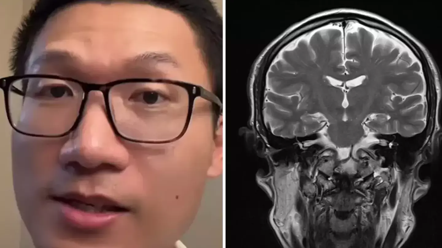 Neurologist reveals the 'most terrifying' condition he’s ever seen