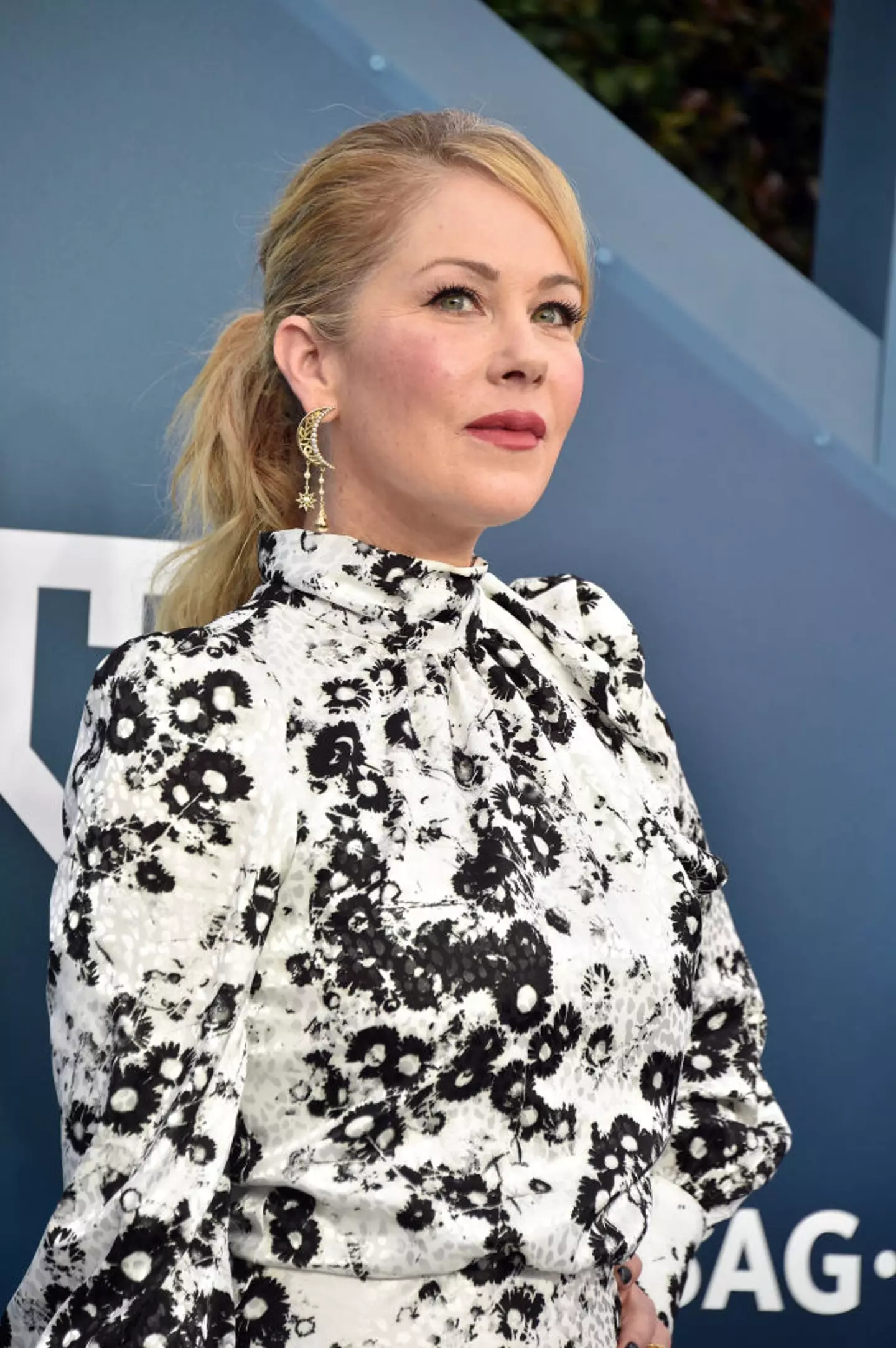 Applegate's been extremely candid over the years about how she deals with the autoimmune condition (Gregg DeGuire / Stringer / Getty Images)