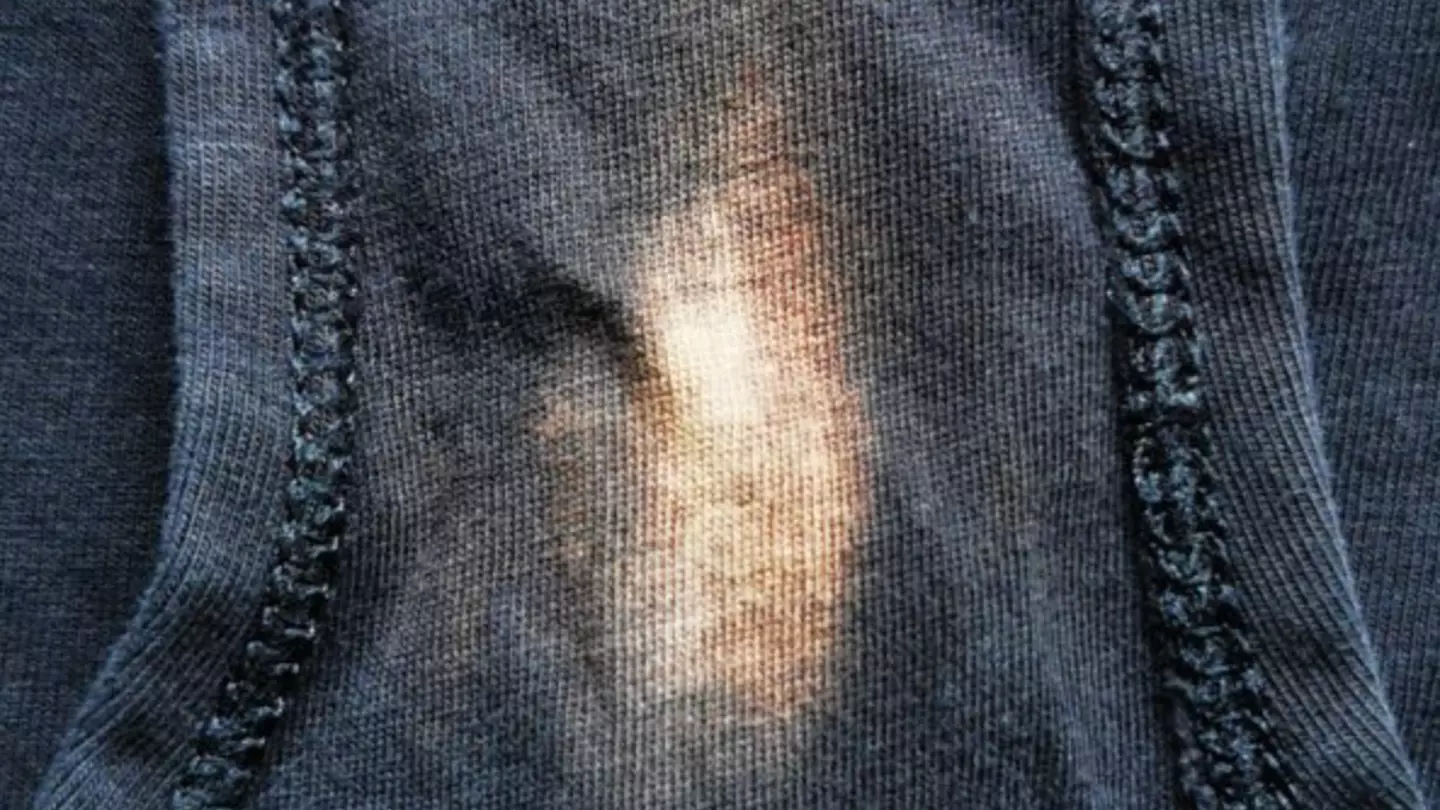 Reason why you might find a bleach stain in your underwear