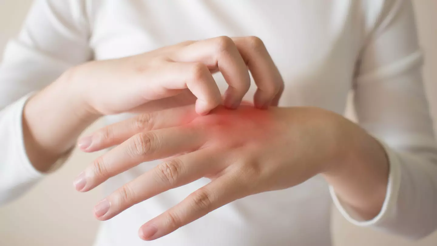 Rash Could Be A Little-Known Omicron Symptom, Expert Warns