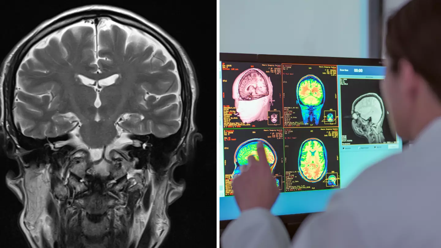 Neurologist reveals the single scariest thing she sees people doing to their brains