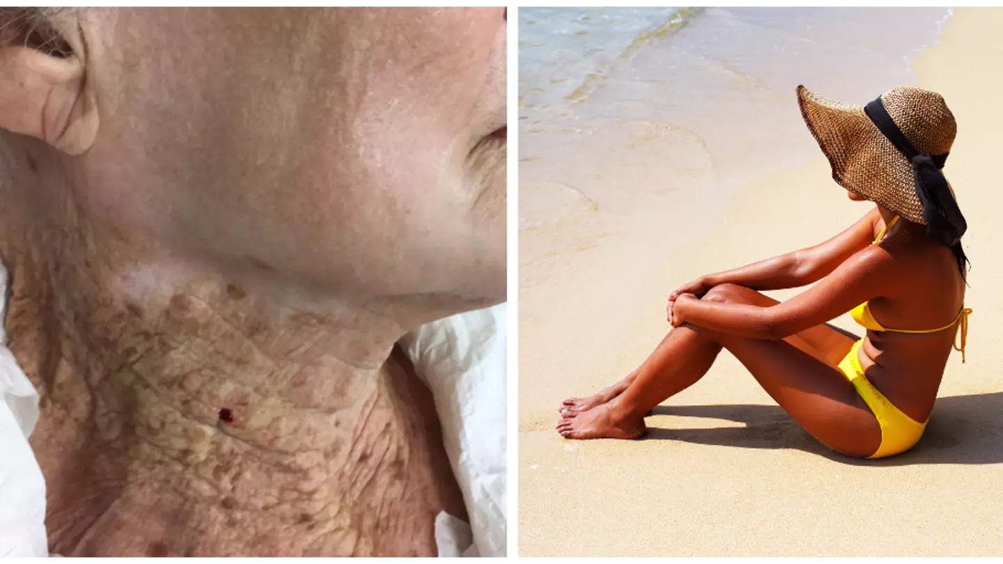 People will be shocked to see the difference that wearing sun cream can make to your skin