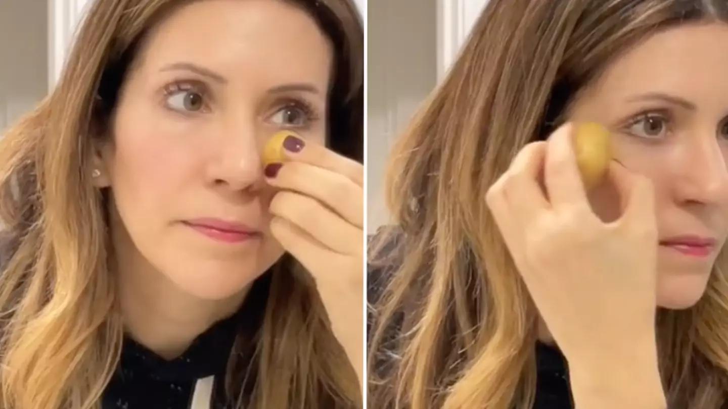 Skincare expert explains science behind viral dark circles potato hack