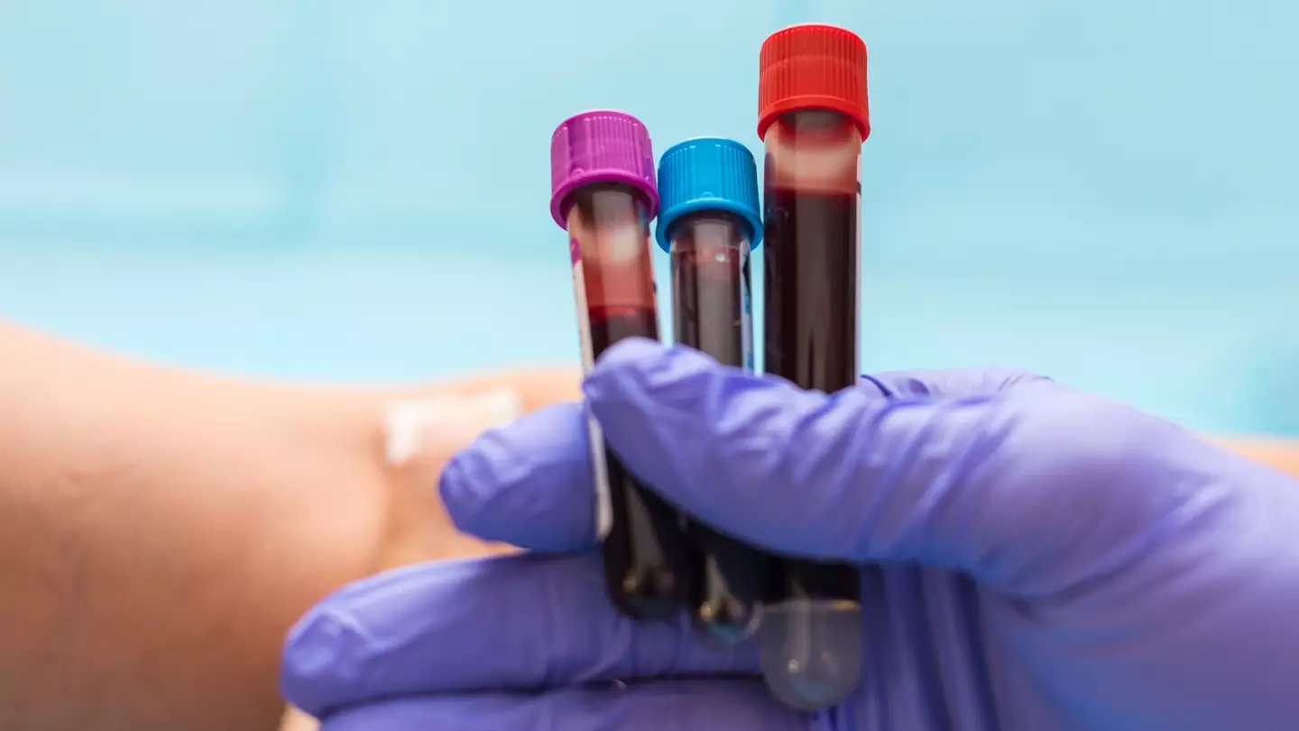 Scientists discover new blood group after 50 years