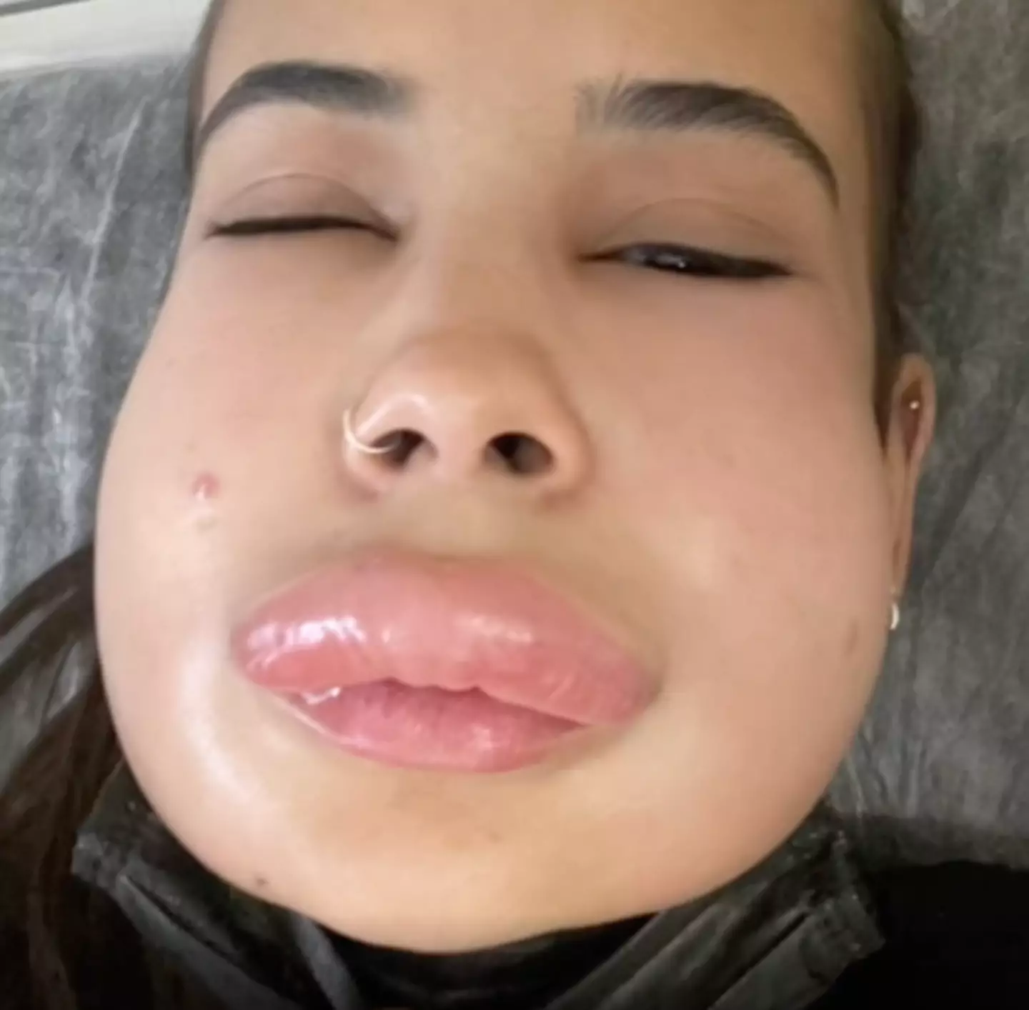 Isis' face didn't go back to normal for four days.