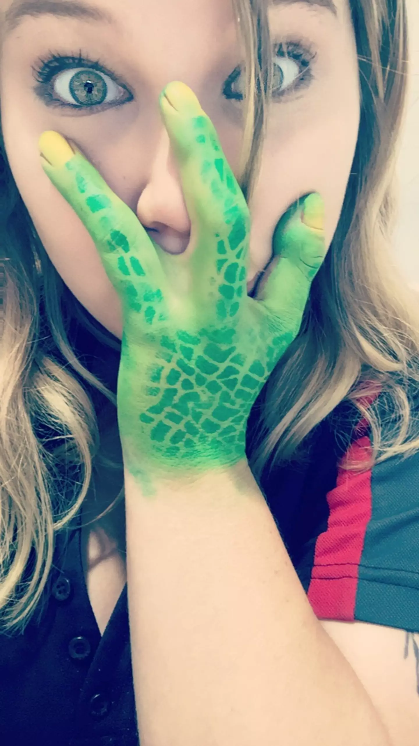 Cassidy said she's 'rolling with the punches' about her hands.