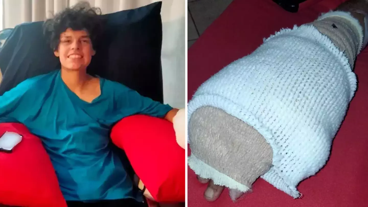 15-year-old boy loses fingers and left seriously injured after horrific vaping accident
