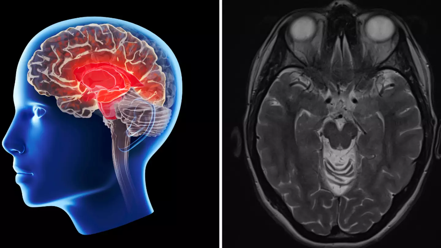 4 red flags your brain is in trouble as scientists warn Alzheimer’s starts decades before you realise