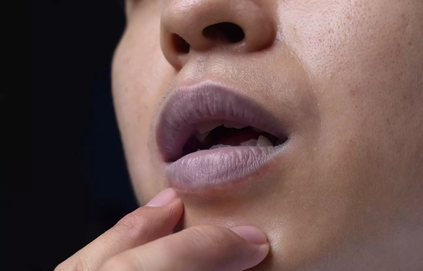 Cyanosis happens when there's not enough oxygen in your blood. (Zay Nyi Nyi / Getty Images)