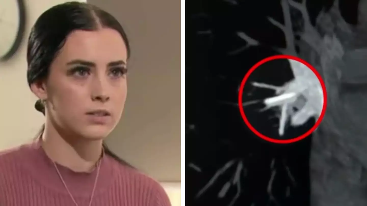 Woman left needing open-heart surgery after birth control goes horribly wrong