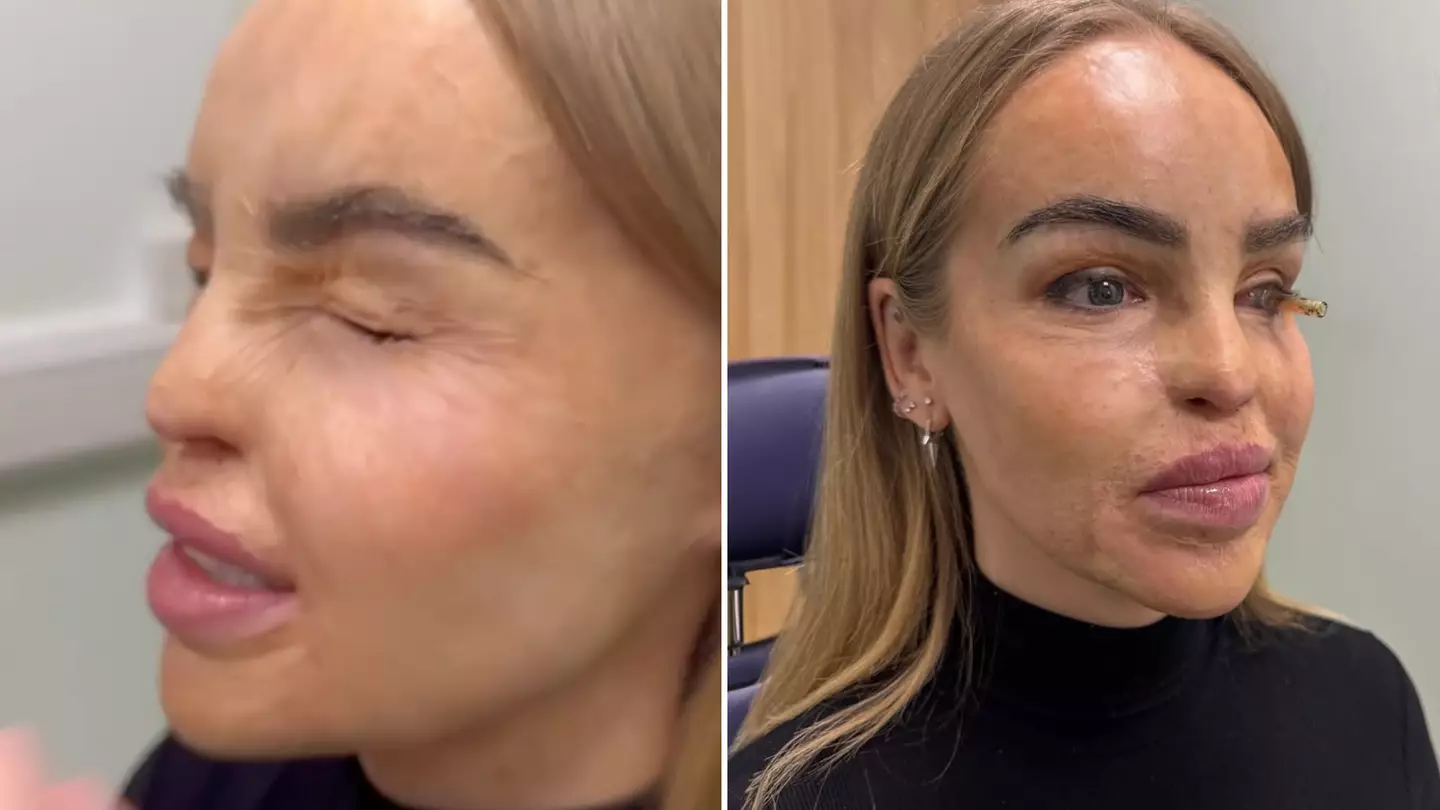 Katie Piper issues health update after after 'years of battling with eye'