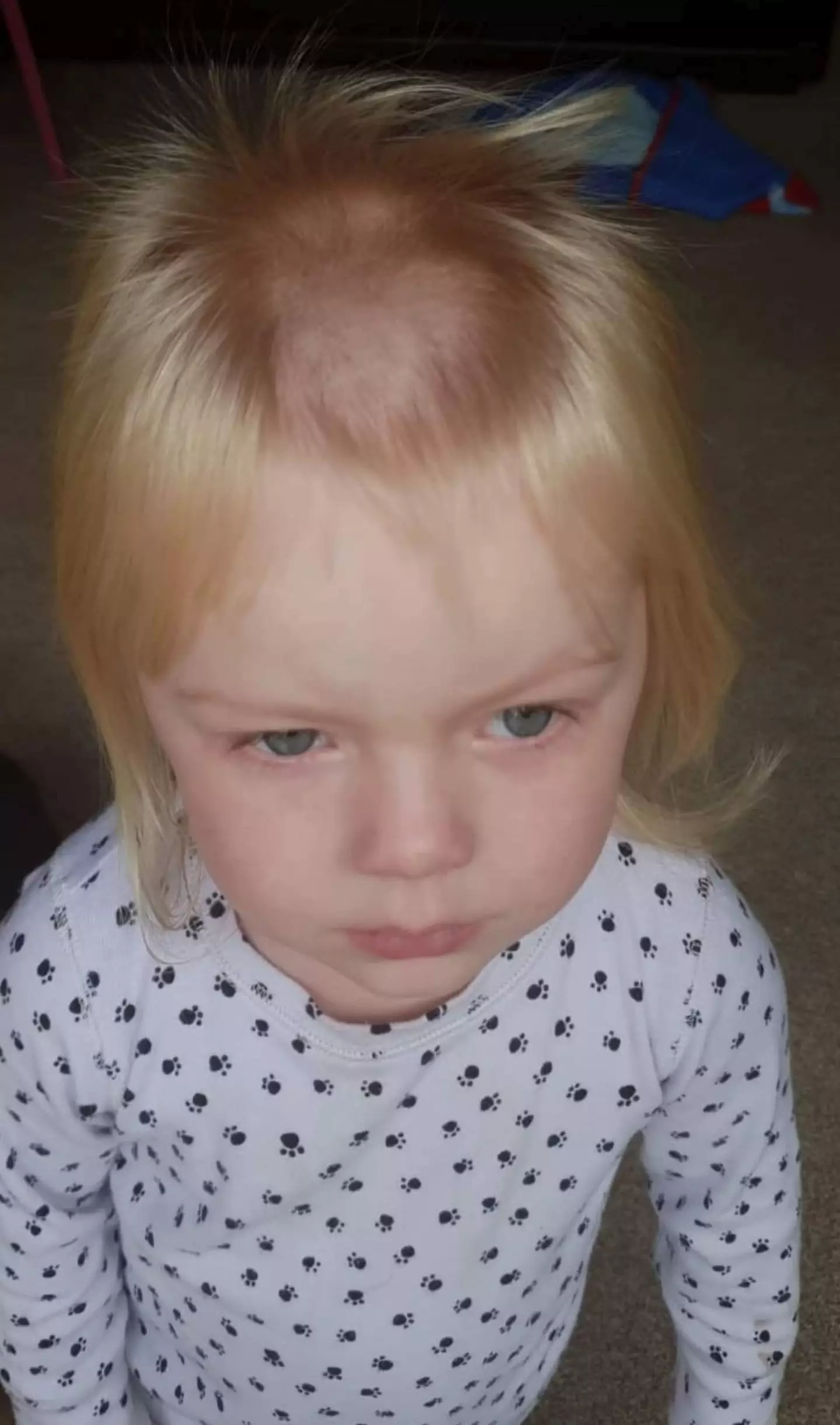 The toddler immediately after the hair mishap (