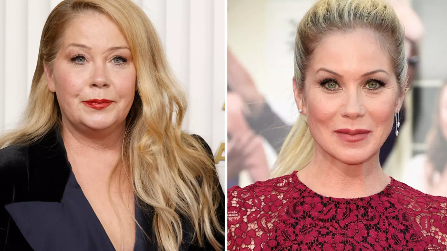 Christina Applegate reveals the one plastic surgery she’s had after famous producer made comments about her face