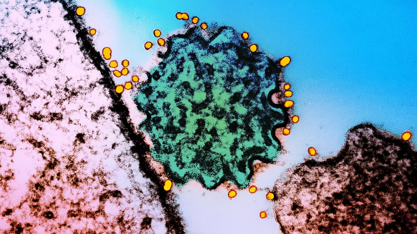 What you should know about Nipah virus following deadly outbreak