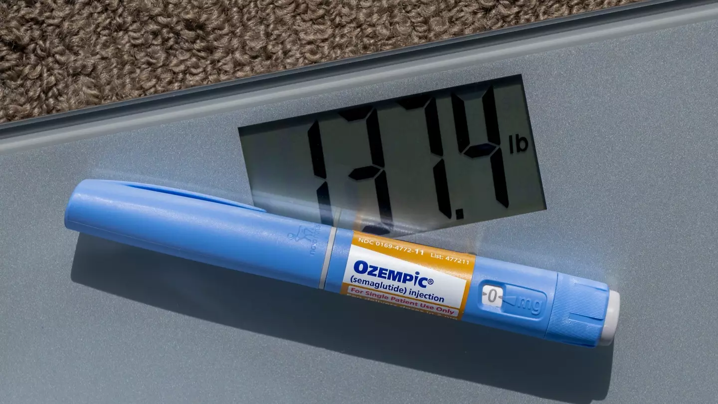 Michael Siluk/UCG/Universal Images Group via Getty Images