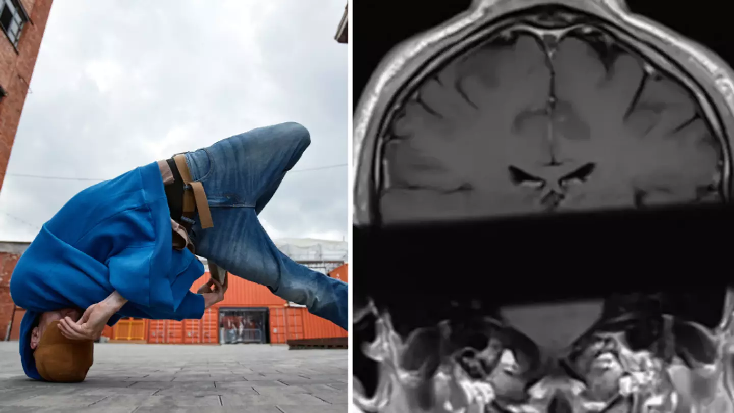 Disturbing ‘headspin hole’ images show hidden dangers of breakdancing
