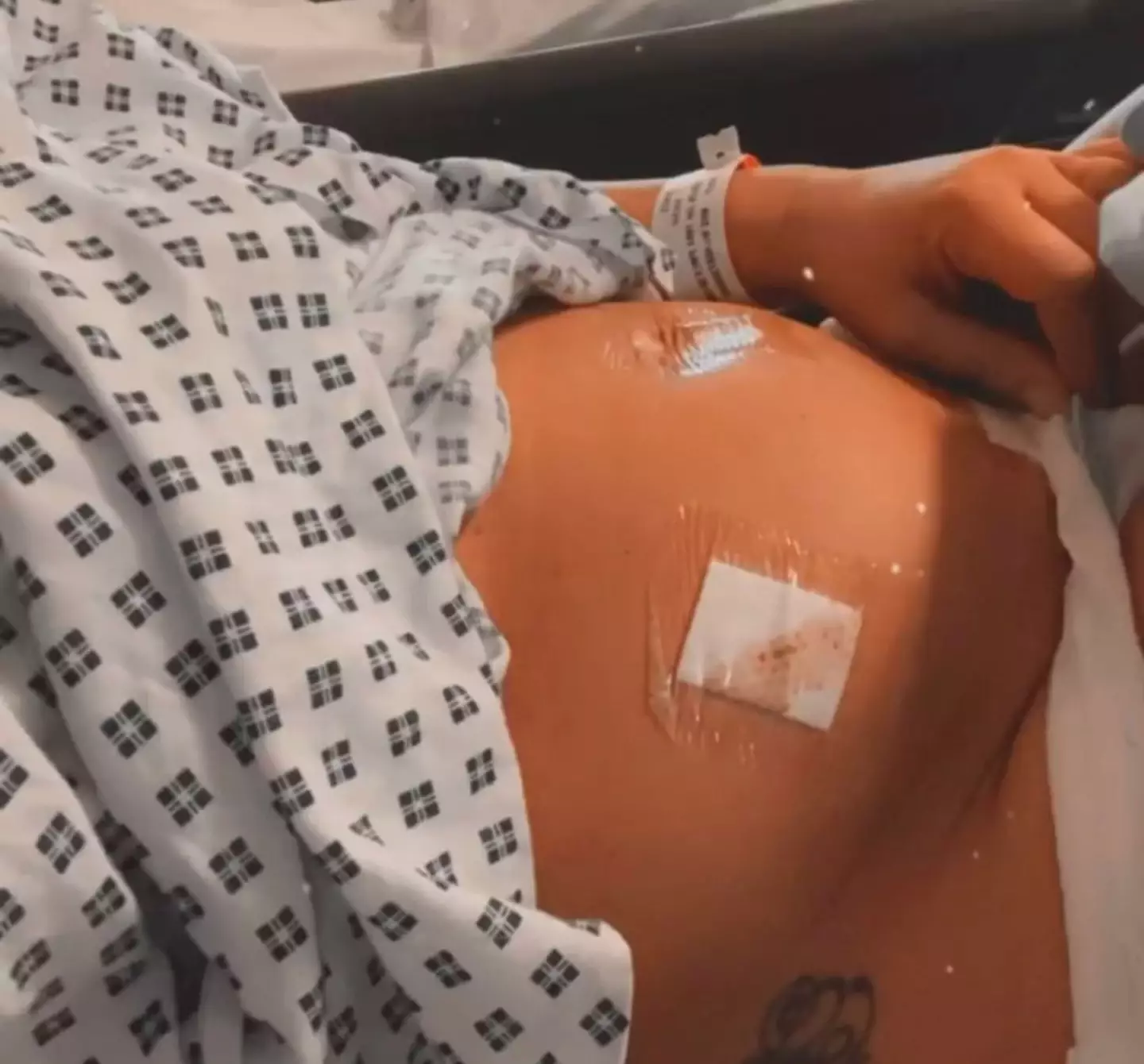 She still worries about whether her child will one day be diagnosed with the same condition.