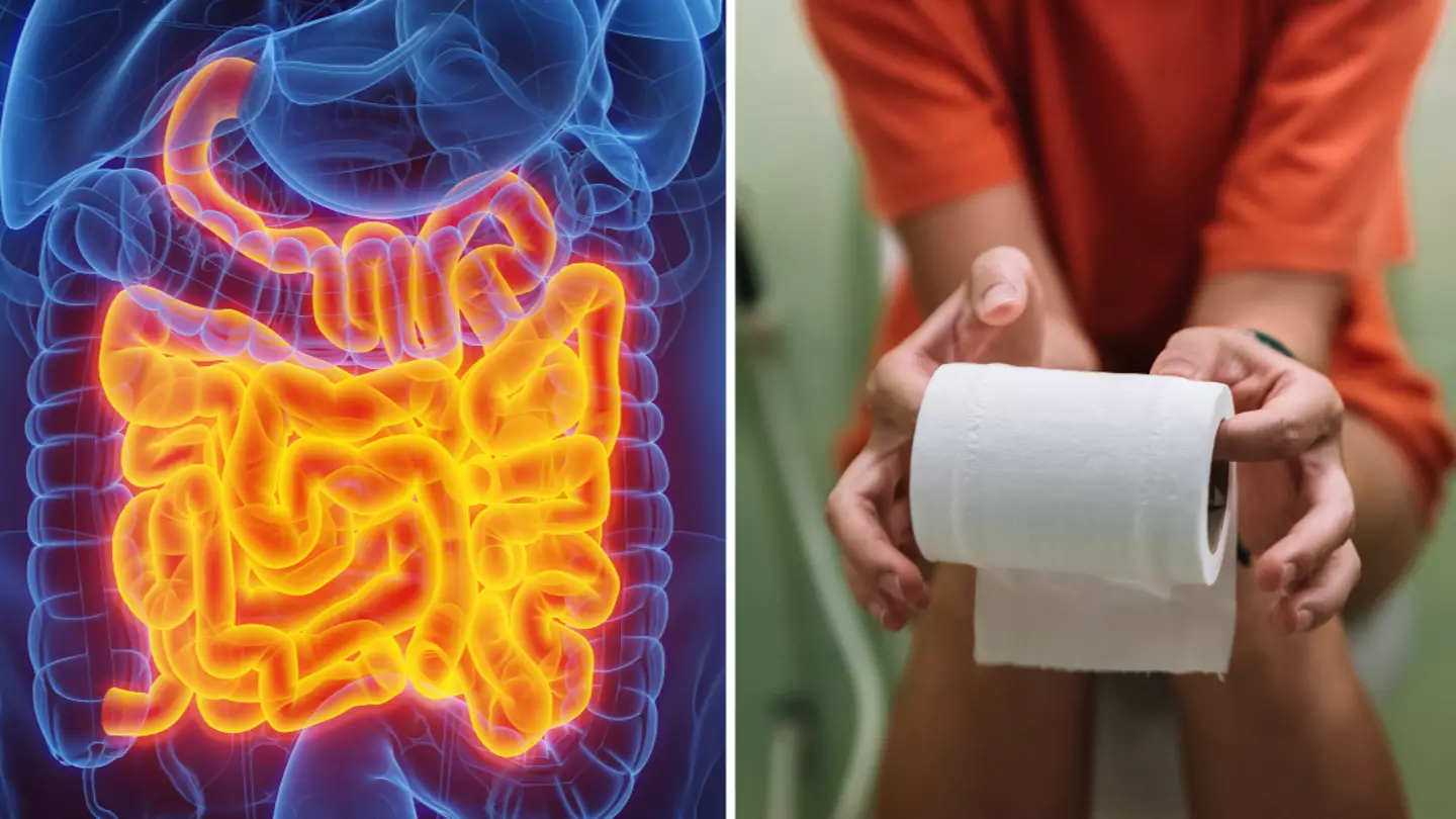 Doctor says certain type of poo is a 'highly concerning' red flag for cancer