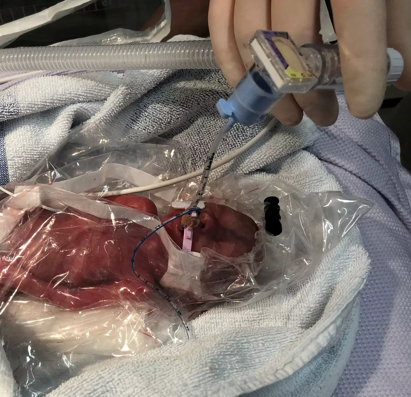Combined, the triplets weight a total of just 2.83lb (1.284kg).