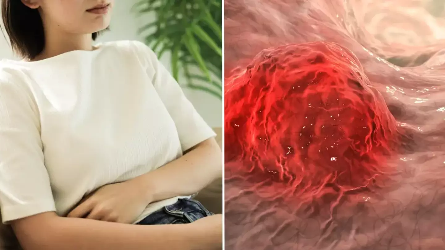 Official advice on 'silent killer' on the rise among Gen Z and Millennials after doctors reveal reason why